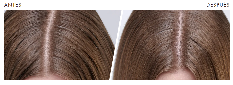 Antes y después tratamiento cuero cabelludo seco
